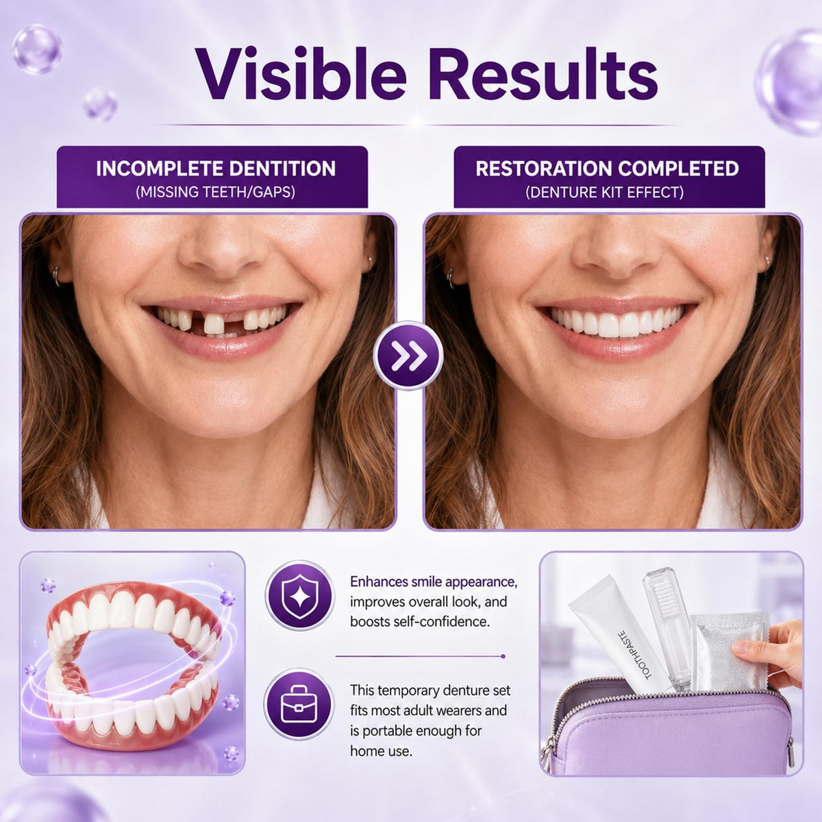 Heat Moldable Temporary Denture Kit 1 Set M7322